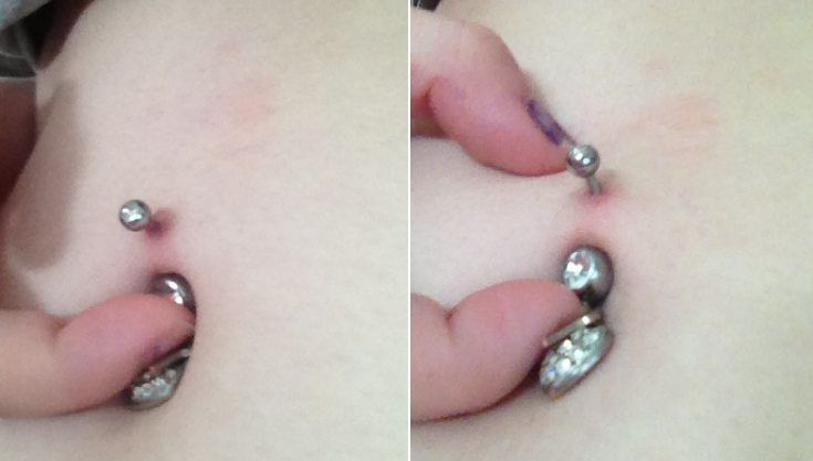 Signs belly button piercing 2025 is healing
